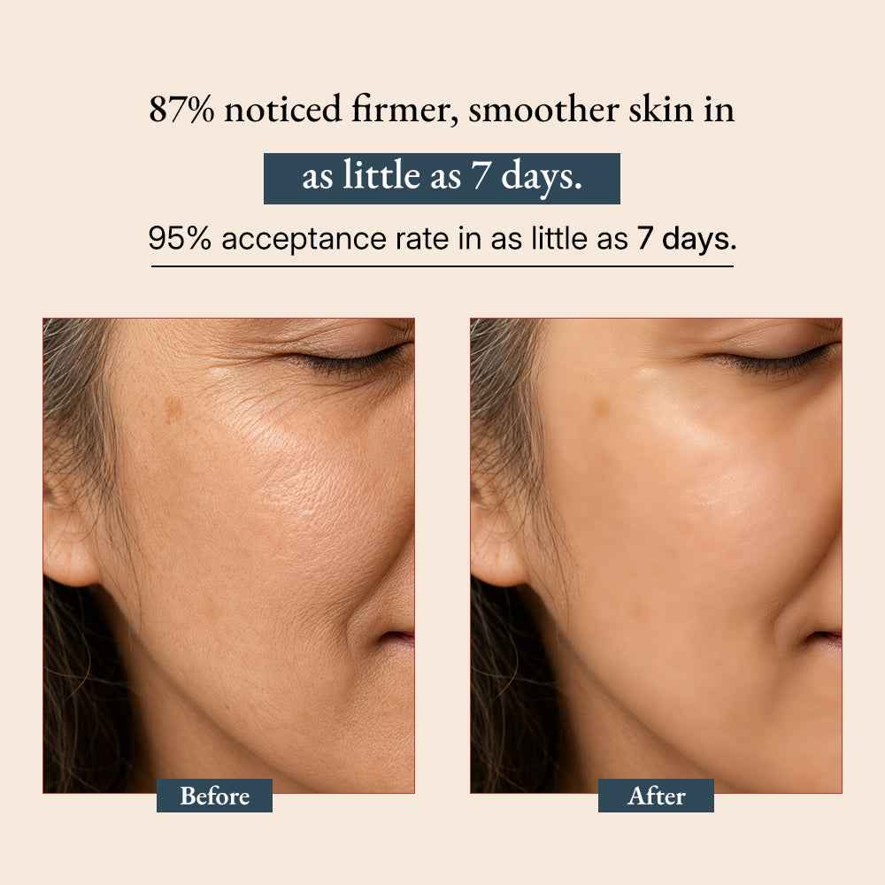 Green-Beauty Co Supercharge Bakuchiol Retinol Serum