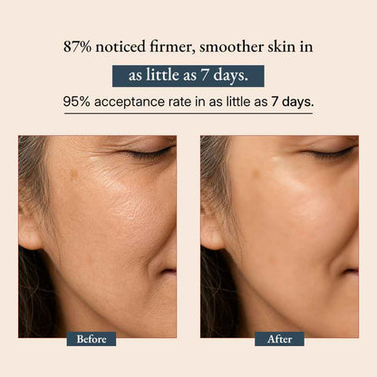 Green-Beauty Co Supercharge Bakuchiol Retinol Serum