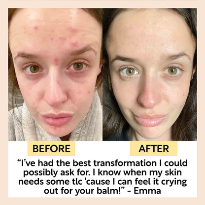 UpCircle Cleansing Face Balm with Oat Oil & Vitamin E, Travel Size