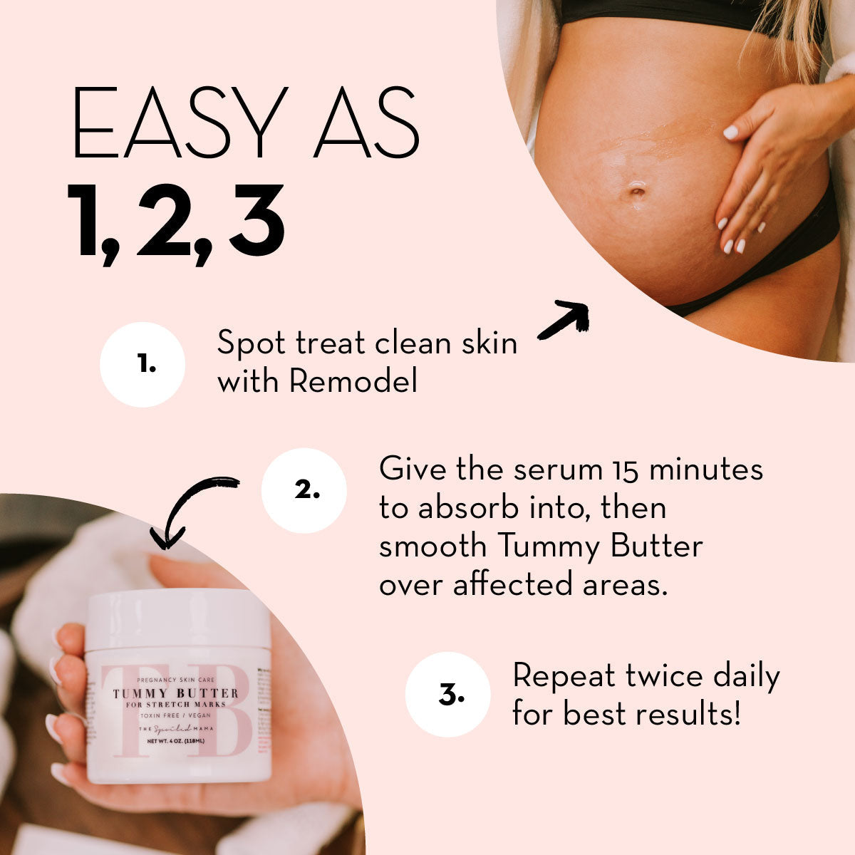 The Spoiled Mama ReModel Serum for Stretch Marks