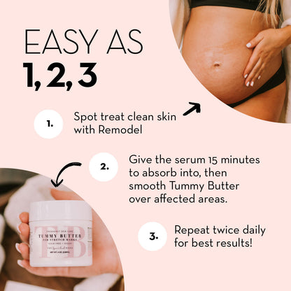 The Spoiled Mama ReModel Serum for Stretch Marks