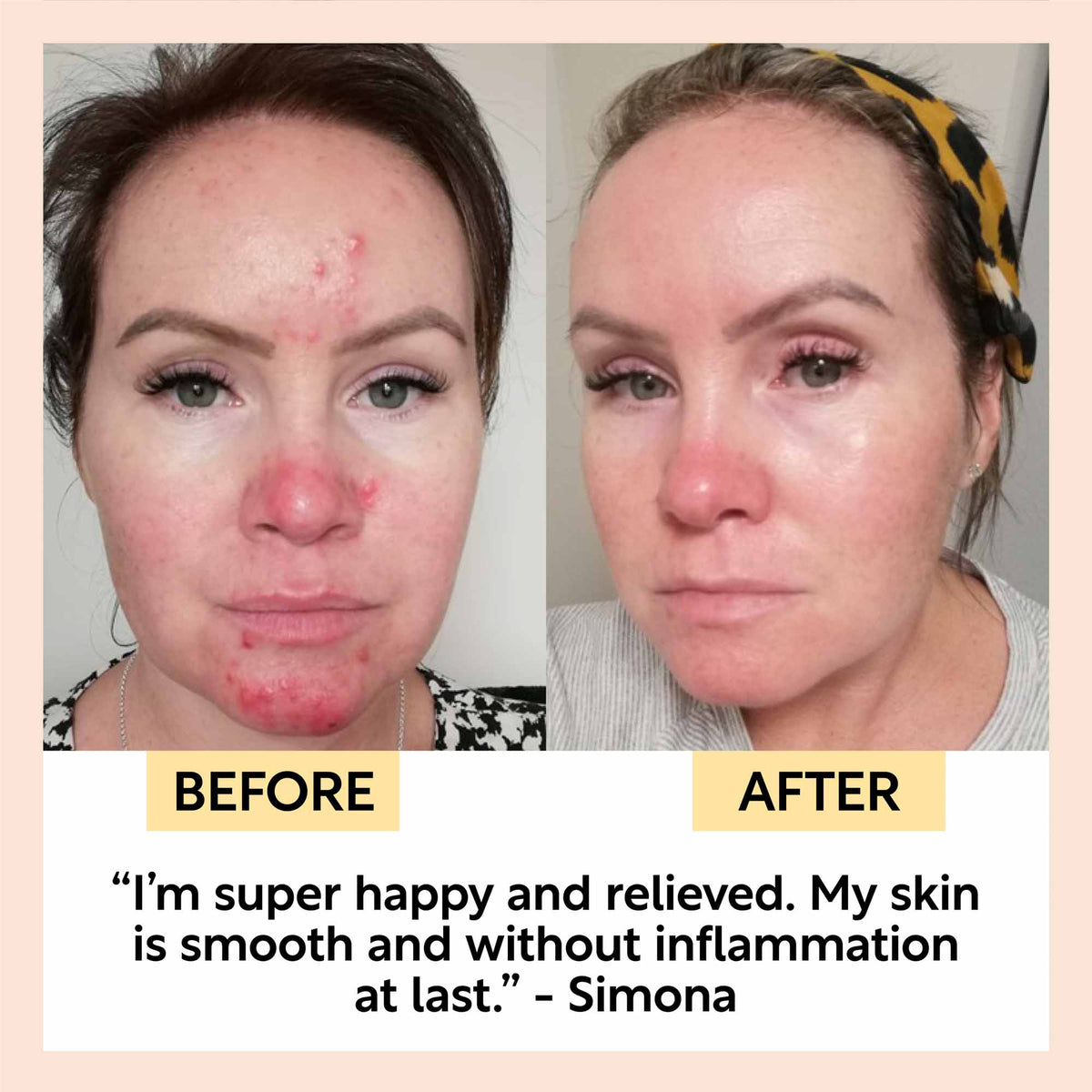 UpCircle Night Cream with Hyaluronic Acid & Niacinamide