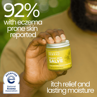 Ora's Amazing Herbal Touchy Skin Salve, Eczema Cream Ointment