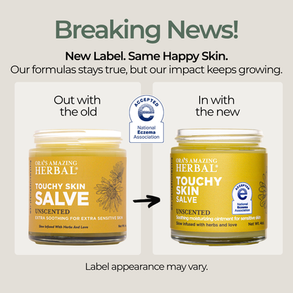 Ora's Amazing Herbal Touchy Skin Salve, Eczema Cream Ointment